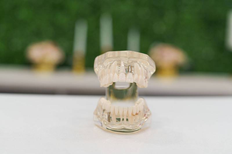 teeth, molars, gums and bite. medical object in studio