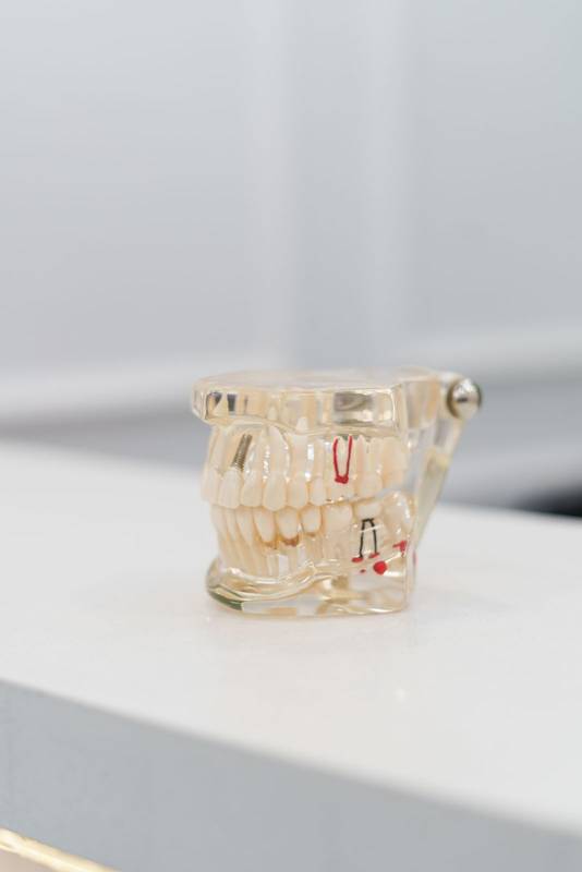 modern glass denture, didactic article for teaching